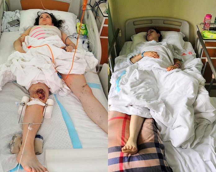 Объявлен сбор средств на лечение двух свободненских девушек, разбившихся в Китае